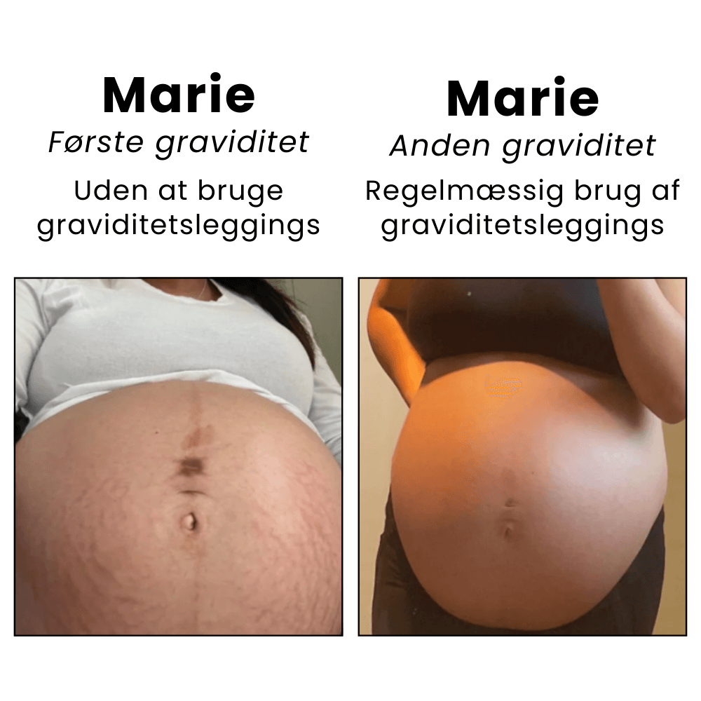 MamaFit™ - Graviditetsleggings (1+1 Gratis)