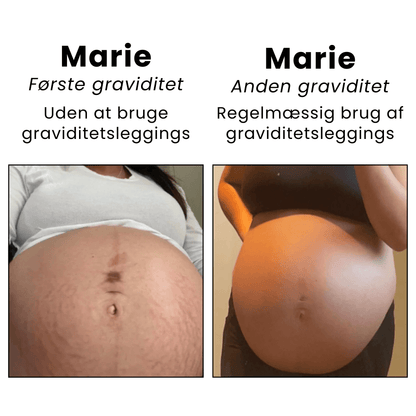 MamaFit™ - Graviditetsleggings (1+1 Gratis)